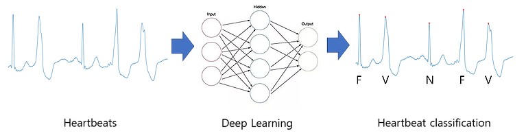 Arrhythmia Classification with Deep Learning | BCML Lab.