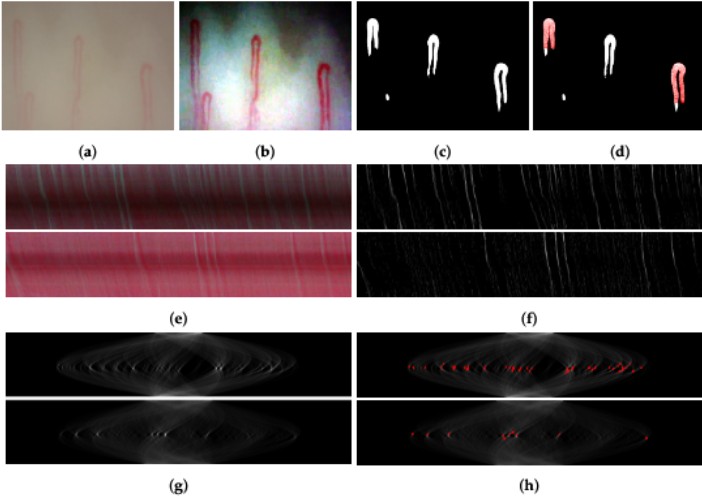 Nailfold Capillaroscopy Platform visual